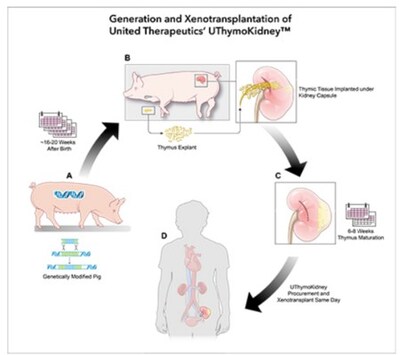 Generation and Xenotransplantation of United Therapeutics’ UThymoKidneyTM