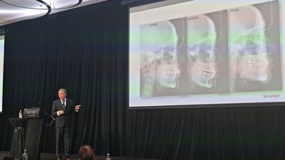 Professor Shen's lecture emphasized Smartee Mandibular Repositioning TECHNOLOGY which aims to reposition the mandible forward, promote TMJ remodeling, restore Class I occlusion, and treat severe Class II and Class III malocclusions effectively. (PRNewsfoto/Smartee Denti-Technology)