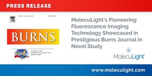 MolecuLight's Pioneering Fluorescence Imaging Technology Showcased in Prestigious Burns Journal in Novel Study