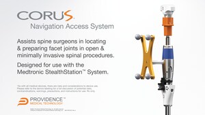 Providence Medical Technology, Inc. Announces FDA Clearance of CORUS™ Navigation Access System for Use with Medtronic's StealthStation™ Surgical Navigation in Posterior Spinal Fusion