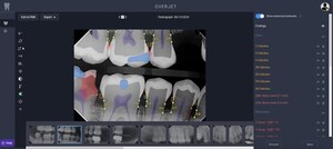 Introducing Overjet for Educators: AI Built for Dental Education