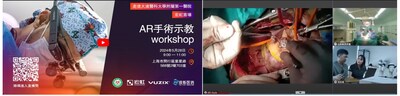 A replay of the cardiac surgery performed at the First Affiliated Hospital of Dalian Medical University can be viewed at  https://www.youtube.com/live/_uRk38RIkUc