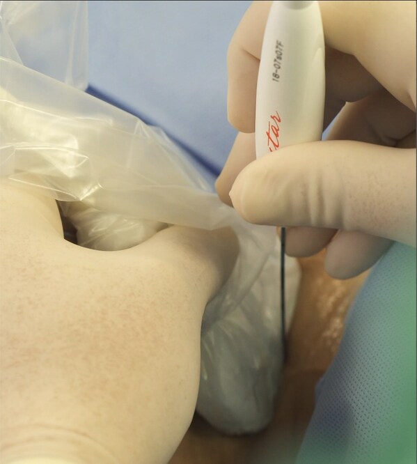 Unable to view the image, Please provide a valid URL.