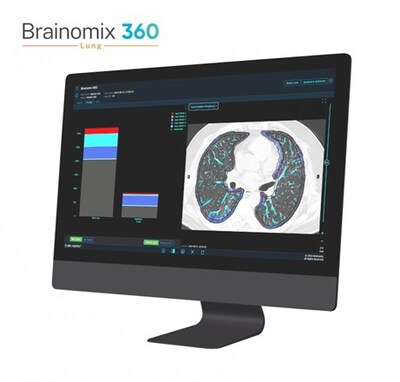 Brainomix 360 e-Lung