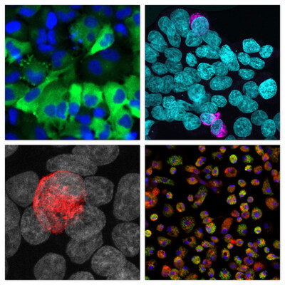 Top left: The nuclei of human cells appear in blue. The green signal indicates the presence of a dengue virus protein. Top right: The nuclei of human cells appear in teal. The magenta signal indicates the presence of a dengue virus protein. Bottom left: The nuclei of human cells appear in grey. The red signal indicates the presence of a dengue virus protein. Bottom right: The nuclei of mosquito cells appear in blue. The red and green signal indicates the presence of two dengue virus proteins.