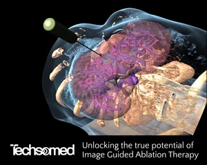 Techsomed Announces U.S. Launch of BioTraceIO Vision and BioTraceIO Precision Software for Image-Guided Ablation Therapy