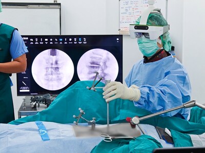 Dr. Chaiyos Chaichankul performing surgery using the Caduceus S AR navigation system in C-arm module