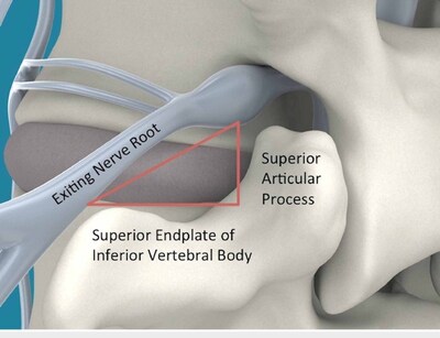 Anatomy of Kambins Triangle