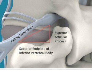 Avicenna Technical University and Inspired Spine Launch the Kambin Society