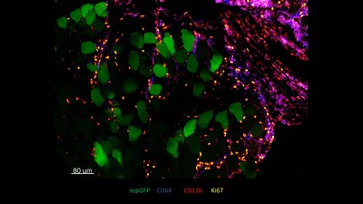 Transverse section of mouse muscle injected with LION/repRNA encoding green fluorescent protein. 

Credit: HDT Bio; Dr. Joseph Leal