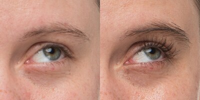 NULASTIN® | Left: before treatment. Right: after using NULASTIN® BROW Shape Altering Serum and LASH Follicle Fortifying Serum for 12 weeks.