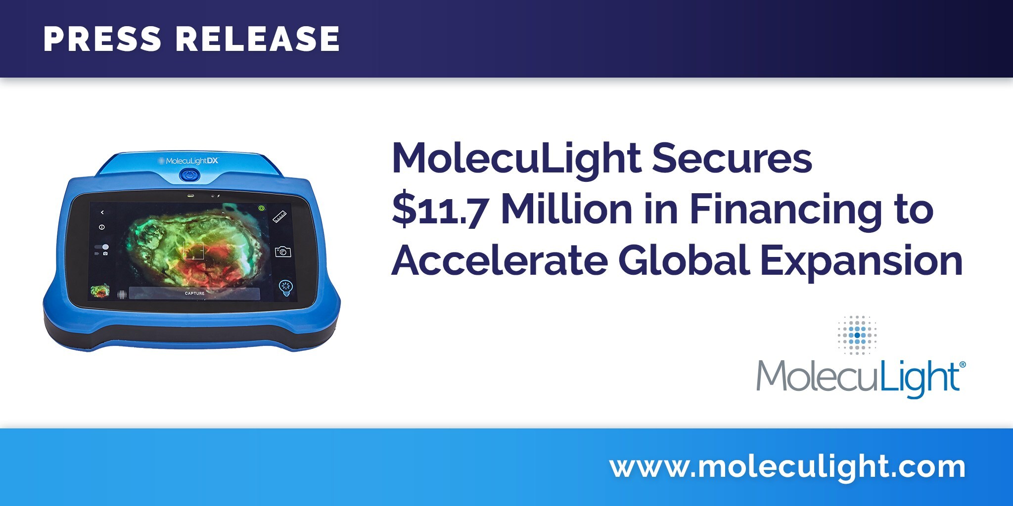 MolecuLight obtient un financement de 11,7 millions de dollars pour accélérer son expansion mondiale