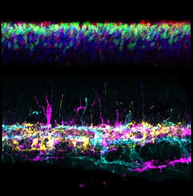 This confocal image shows a montage of rod development (red, green, blue) and ipRGC development (cyan, magenta, yellow) in the mouse retina. Note the thin processes emerging from the ipRGCs (hybrid neurites) that are used to communicate with developing rods. Source: Cincinnati Children's