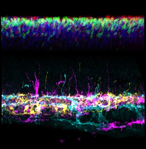 Improved Light Control Might Help Prevent Eye Problems in Premature Infants