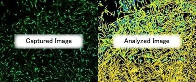 Example images of neurite outgrowth assay (left: captured image; right: analyzed image. Yellow: neurites, green: nerves, blue: nuclei, orange: number of branches).