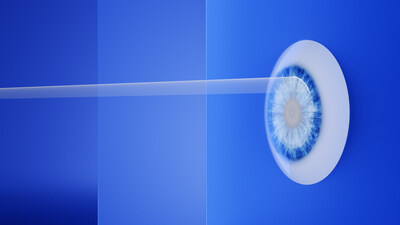 Hyperopia Indication for ZEISS SMILE pro