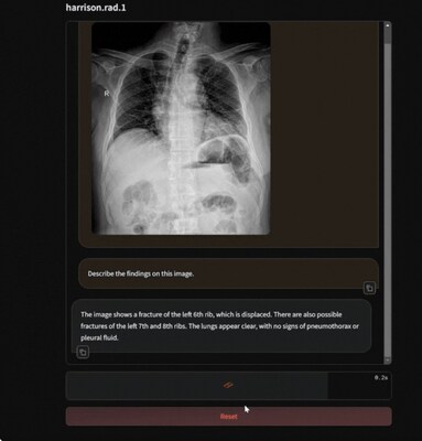 Introducing Harrison.rad.1, the latest frontier in radiology-specific foundational models.