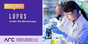 Arthritis Research Canada Presents Latest Lupus Research in Free Webinar