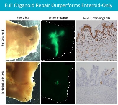 An advanced cellular therapy product developed by experts at Cincinnati Children’s appears to outperform another method that prompts growth only of the surface epithelial layer of the intestine. The middle column of images shows the extent of new cell growth in bright green. The right column shows repaired tissue, with organoid-based cells in brown. Details about the new cellular therapy were published Sept. 12, 2024, in Cell Stem Cell.