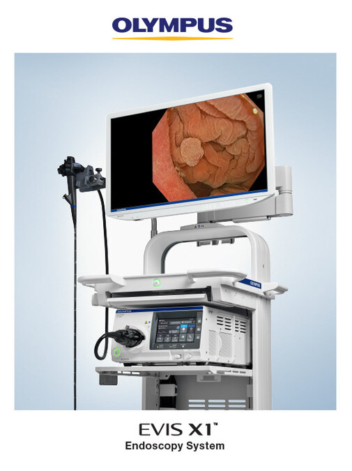 Olympus Selected to Exhibit EVIS X1™ Endoscopy System at Vizient Innovative  Technology Exchange