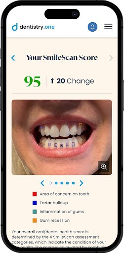 Dentistry.One Launches Smilescan: A New AI-Driven Tool for Easy Dental Wellness Checks