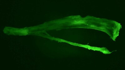 Bioluminescence imaging allowed for individual cancer cells to be isolated in the tibia, as seen here. Image: Ryan Serio, Nowak lab/Weill Cornell Medicine