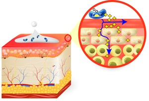 National Institutes of Health (NIH) Awards ResVita Bio a $2M Phase II SBIR Grant for Continuous Protein Therapy for Netherton Syndrome