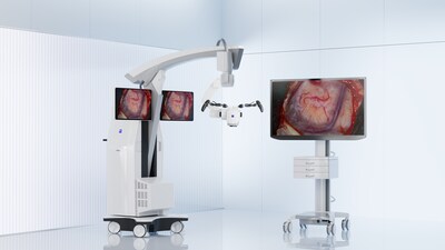 With best digital visualization and seamless robotic interactions, ZEISS KINEVO 900 S is representing a (r)evolution in the market.