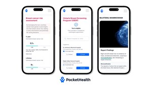 PocketHealth Launches New Breast Health Tools to Help Detect Breast Cancer Earlier