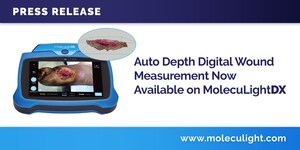 La mesure numérique de la profondeur automatique des plaies est désormais disponible sur MolecuLightDX