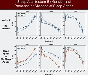 Groundbreaking Very Large Sleep Study Reveals Unprecedented Insights into Sleep Patterns Across Age Groups