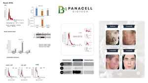 The Exosome Production Method Patent by Panacell Biotech Registered as Original Technology