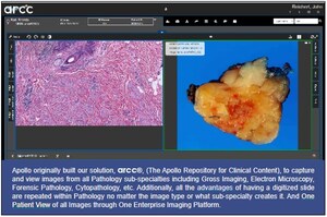 Apollo to Showcase Digital Pathology Enhancements for Connecting Pathology to the Healthcare Enterprise at DPA Pathology Visions 2024