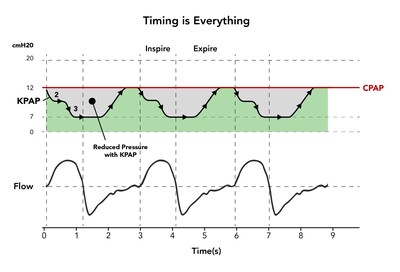 Differences in pressure (cmH2O) between KPAP™ and CPAP:
While the pressure of CPAP remains constant throughout the breathing cycle (red line), KPAP drops pressure by 2cm and then 3cm H2O during inspiration (i.e. total pressure drop of 5cm H2O below therapeutic pressure), keeping it down until it’s raised back to therapeutic pressure toward the end of expiration. The grey area indicates the magnitude and duration of this lower pressure.