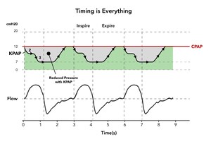 New CPAP Device with Much Lower Pressure Found as Effective as Traditional CPAP and Reported to be More Comfortable