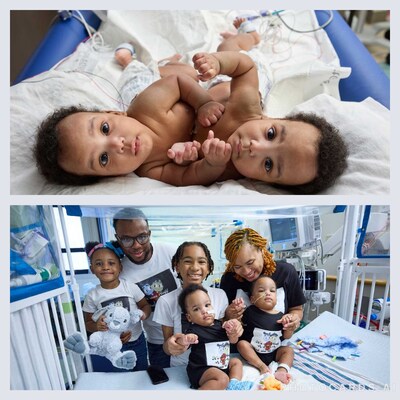 <div>Children's Hospital of Philadelphia Successfully Separates Conjoined Twin Boys</div>