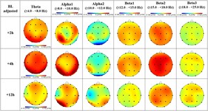 Lipocine Announces Positive Oral Brexanolone Quantitative EEG Results