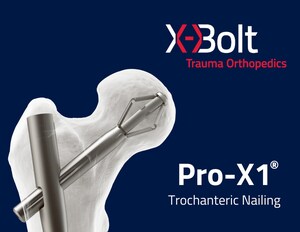 X-Bolt Announces First U.S. Implant of Pro-X1® Trochanteric Nailing System