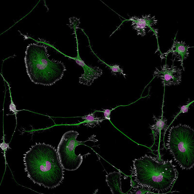 Differentiated mouse brain tumor cells (actin, microtubules, and nuclei)