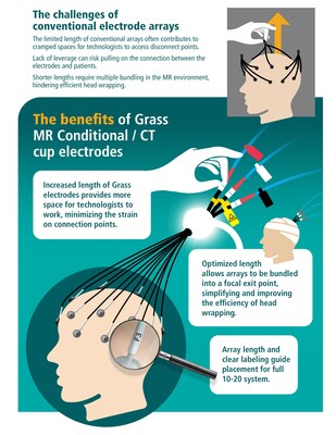 Discover the benefits of the Natus Grass MR Conditional / CT cup electrodes!