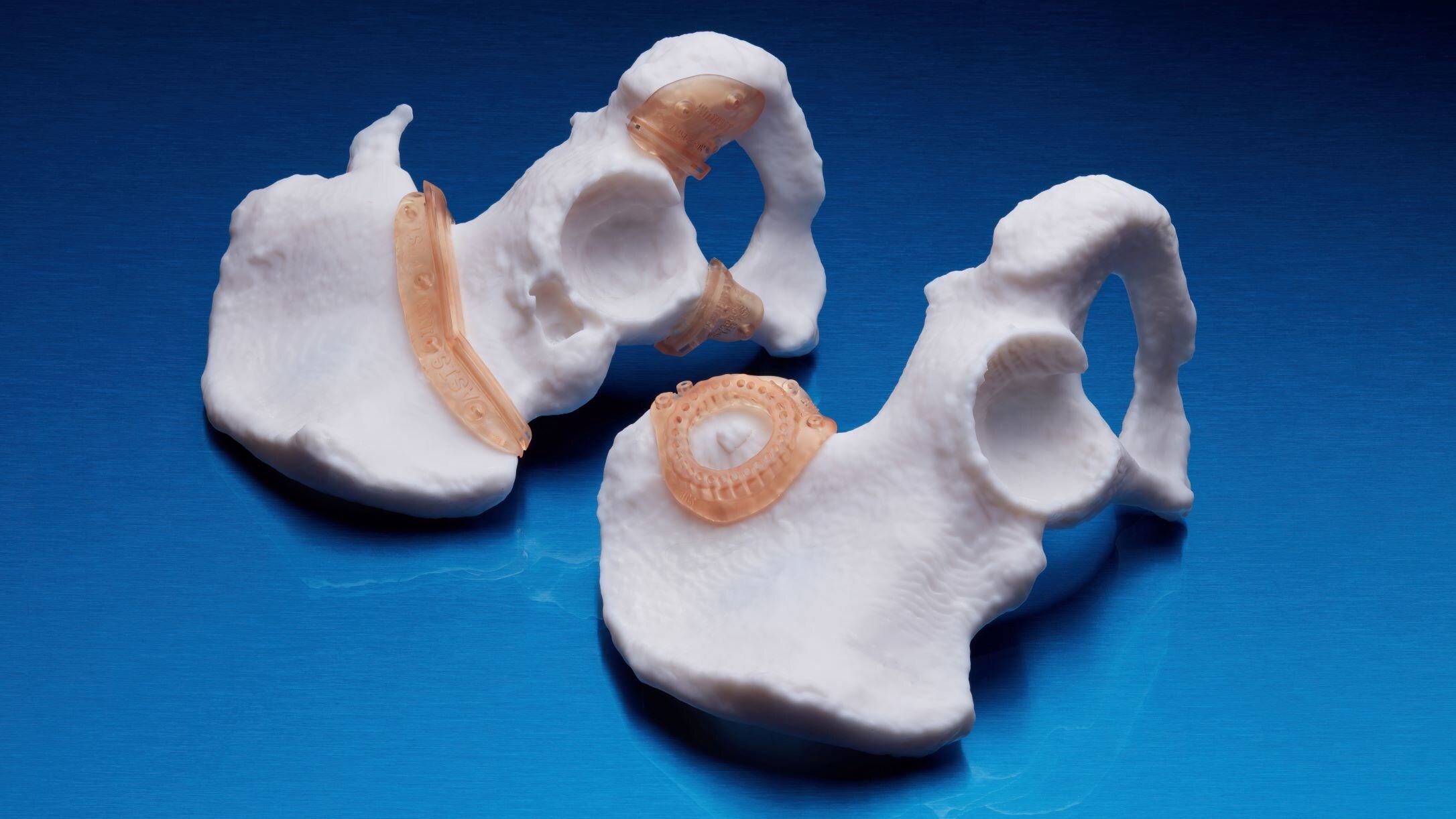 RICOH 3D for Healthcare and Insight Surgery join forces to offer patient-specific orthopedic and maxillofacial guides