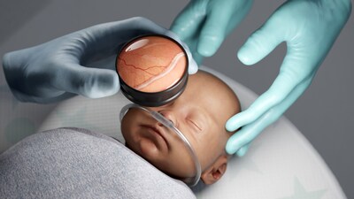 Pediatric Retinopathy of Prematurity