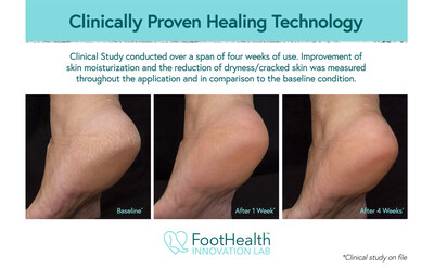 Clinically Proven Healing Technology