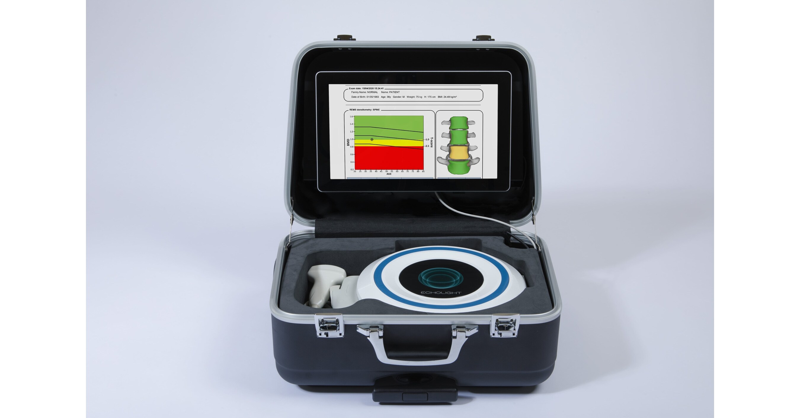 NASA Enhances Bone Health Monitoring in Spaceflight Simulations with Echolight Devices