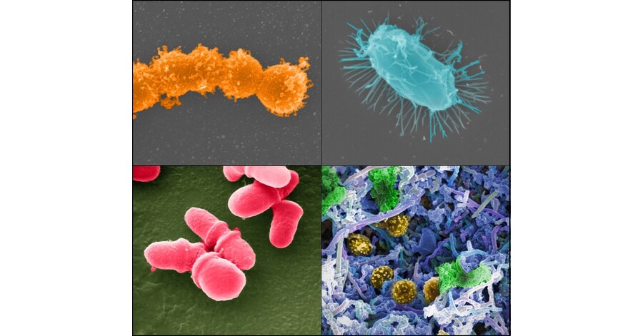 City microbes surviving on disinfectants, research reveals