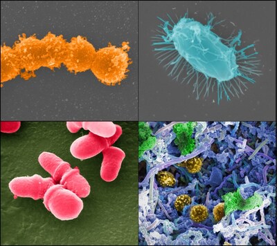 The Human Microbiome Project, which was launched by NIH in 2007, provided the first glimpse of the microbial diversity of healthy humans and is exploring the possible relationships between particular human diseases and the microbiome. (Clockwise from top left): Streptococcus (Credit: Tom Schmidt); Microbial biofilm, of mixed species, from the human body (Credit: A. Earl, Broad Institute/MIT); Bacillus (Credit: Tom Schmidt); Malassezia lopophilis (Credit: J.H, CDC). Credit: Jonathan Bailey, NHGRI