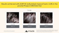 Phase 3 STRATUM trial before and after (CNW Group/Arcutis Canada Inc.)