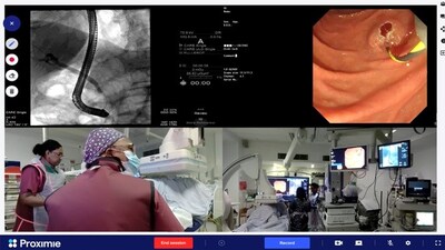 Proximie allows consulting clinicians to gain remote access to the procedure room as illustrated in this image showing the Proximie user interface during an endoscopic procedure.