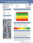 AutoBMD sample report