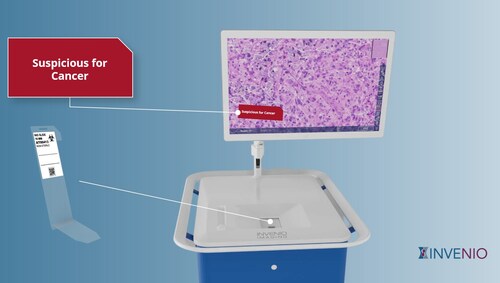 NIO Laser Imaging System with NIO Lung Cancer Reveal image analysis module.